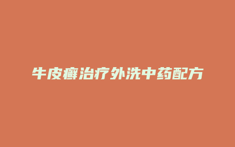 牛皮癣治疗外洗中药配方